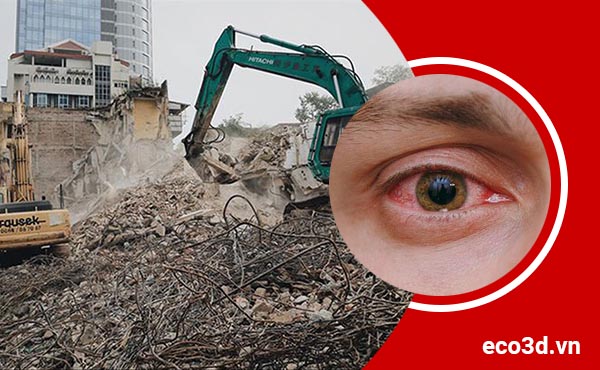 Các bệnh về mắt tại công trường xây dựng