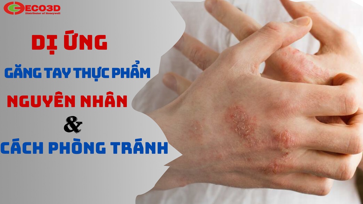 Dị Ứng Găng Tay Thực Phẩm Cao Su - Nguyên Nhân Và Cách Phòng Tránh